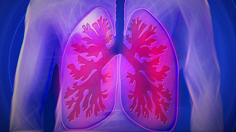 Biopharma Announces Pulmonary Fibrosis Trial Now 25% Enrolled