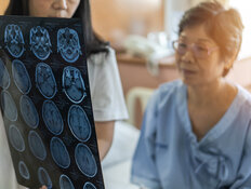 Investors: Will a Psychedelic Drug Take This Pharma Stock to the Next Level?