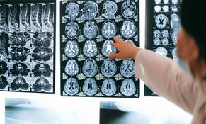 Drug Re-Purposing Co. Pursues Novel Stroke Therapies