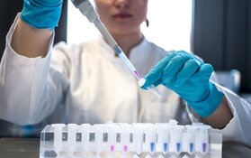 uniQure Epilepsy Gene Therapy Data Draws Investor Focus