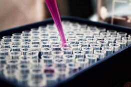 Abivax SA (ABVX:NASDAQ) UC Data Fuels Biotech Opportunity
