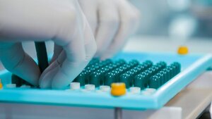Coya Therapeutics Advances COYA 302 ALS Trial With 100th Participant