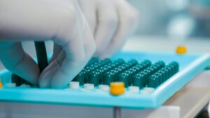 AI-Designed Cancer Drug Shows In Vivo Results, Brain Penetration